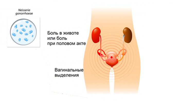 Сексуальное здоровье лесбиянок и бисексуалок